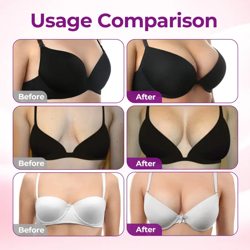 💥Nuravii® 💥Targeted Breast Enhancement Advanced Nano Microneedle Patch💥💥💥